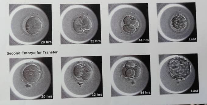 Exploring the Certificate in Advanced Embryology ICSI Exploring the Certificate in Advanced Embryology ICSI